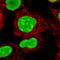 Poly(ADP-Ribose) Polymerase 1 antibody, HPA045168, Atlas Antibodies, Immunofluorescence image 