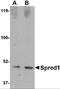 Sprouty Related EVH1 Domain Containing 1 antibody, NBP2-81927, Novus Biologicals, Western Blot image 
