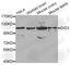 DIS3 Homolog, Exosome Endoribonuclease And 3'-5' Exoribonuclease antibody, A8027, ABclonal Technology, Western Blot image 