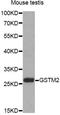 Glutathione S-transferase Mu 2 antibody, A13496, ABclonal Technology, Western Blot image 