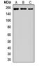 Poly(ADP-Ribose) Polymerase Family Member 4 antibody, LS-C667880, Lifespan Biosciences, Western Blot image 