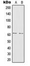 Interleukin 20 Receptor Subunit Alpha antibody, MBS822305, MyBioSource, Western Blot image 