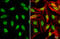 Poly(ADP-Ribose) Polymerase 1 antibody, GTX112864, GeneTex, Immunofluorescence image 