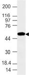 Interferon Induced Protein With Tetratricopeptide Repeats 2 antibody, A04428, Boster Biological Technology, Western Blot image 