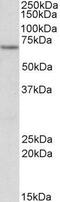 Electron Transfer Flavoprotein Dehydrogenase antibody, GTX88086, GeneTex, Western Blot image 