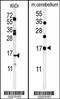 Tubulin Polymerization Promoting Protein Family Member 3 antibody, MBS9209827, MyBioSource, Western Blot image 