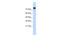 WW Domain Containing E3 Ubiquitin Protein Ligase 2 antibody, 25-817, ProSci, Enzyme Linked Immunosorbent Assay image 