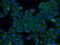 SAM Domain, SH3 Domain And Nuclear Localization Signals 1 antibody, 13063-1-AP, Proteintech Group, Immunofluorescence image 