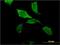 ZBP1 antibody, H00081030-M01, Novus Biologicals, Immunocytochemistry image 