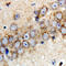 Parkin RBR E3 Ubiquitin Protein Ligase antibody, LS-C368456, Lifespan Biosciences, Immunohistochemistry frozen image 