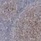 VANGL Planar Cell Polarity Protein 2 antibody, NBP1-81428, Novus Biologicals, Immunohistochemistry paraffin image 