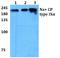 Sodium Voltage-Gated Channel Alpha Subunit 9 antibody, A00920-3, Boster Biological Technology, Western Blot image 