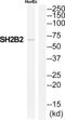 SH2B Adaptor Protein 2 antibody, abx014882, Abbexa, Western Blot image 