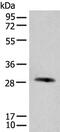 Complement Factor H Related 2 antibody, PA5-68399, Invitrogen Antibodies, Western Blot image 