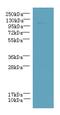 PPFIA Binding Protein 2 antibody, A60370-100, Epigentek, Western Blot image 