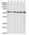 Glucose-6-Phosphate Isomerase antibody, orb20405, Biorbyt, Western Blot image 