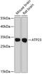 ATP23 Metallopeptidase And ATP Synthase Assembly Factor Homolog antibody, GTX66132, GeneTex, Western Blot image 