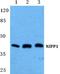Nuclear inhibitor of protein phosphatase 1 antibody, A05396, Boster Biological Technology, Western Blot image 
