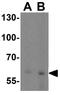 Solute Carrier Family 38 Member 4 antibody, GTX31954, GeneTex, Western Blot image 