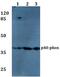 Neutrophil Cytosolic Factor 4 antibody, PA5-75191, Invitrogen Antibodies, Western Blot image 