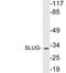 Snail Family Transcriptional Repressor 2 antibody, LS-C200004, Lifespan Biosciences, Western Blot image 