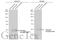 Estrogen Receptor 2 antibody, GTX70174, GeneTex, Western Blot image 