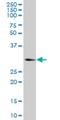 Ketohexokinase antibody, H00003795-M03, Novus Biologicals, Western Blot image 