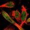 Selenoprotein K antibody, HPA008196, Atlas Antibodies, Immunofluorescence image 