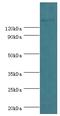 SWI/SNF Related, Matrix Associated, Actin Dependent Regulator Of Chromatin Subfamily C Member 2 antibody, MBS1497629, MyBioSource, Western Blot image 