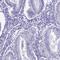 Small Integral Membrane Protein 24 antibody, HPA045046, Atlas Antibodies, Immunohistochemistry frozen image 