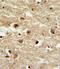 Insulin Like Growth Factor Binding Protein 2 antibody, 63-534, ProSci, Immunohistochemistry paraffin image 