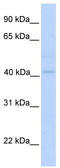 Gasdermin B antibody, TA344156, Origene, Western Blot image 