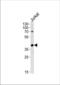 MEK1/2 antibody, TA302209, Origene, Western Blot image 