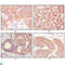 Keratin 5 antibody, LS-C812437, Lifespan Biosciences, Immunohistochemistry paraffin image 