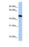 Speckle Type BTB/POZ Protein antibody, ab81163, Abcam, Western Blot image 