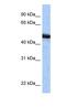 Speckle-type POZ protein antibody, ab81163, Abcam, Western Blot image 