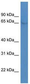 Nuclear Receptor Subfamily 4 Group A Member 1 antibody, TA330634, Origene, Western Blot image 