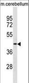 Tropomodulin 2 antibody, LS-C157228, Lifespan Biosciences, Western Blot image 