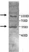 ADAM Metallopeptidase Domain 15 antibody, TA310038, Origene, Western Blot image 