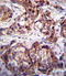 Discoidin Domain Receptor Tyrosine Kinase 1 antibody, LS-C100877, Lifespan Biosciences, Immunohistochemistry paraffin image 