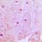 Ubiquitin Domain Containing 1 antibody, GTX56040, GeneTex, Immunohistochemistry paraffin image 