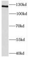 Nuclear Receptor Coactivator 7 antibody, FNab05592, FineTest, Western Blot image 