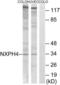 Neurexophilin 4 antibody, LS-C120147, Lifespan Biosciences, Western Blot image 