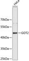 Glutamic-Oxaloacetic Transaminase 2 antibody, 19-200, ProSci, Western Blot image 