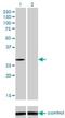 NAD(P)H Quinone Dehydrogenase 1 antibody, H00001728-M01, Novus Biologicals, Western Blot image 