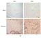 NADPH Oxidase 4 antibody, NB110-58851, Novus Biologicals, Immunohistochemistry frozen image 