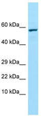 Trehalase antibody, TA338110, Origene, Western Blot image 