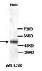 E3 ubiquitin-protein ligase TRIM13 antibody, orb76949, Biorbyt, Western Blot image 