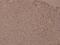 Inhibitor Of Nuclear Factor Kappa B Kinase Subunit Beta antibody, A00118Y188, Boster Biological Technology, Immunohistochemistry paraffin image 