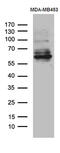 Anosmin 1 antibody, M06684-1, Boster Biological Technology, Western Blot image 